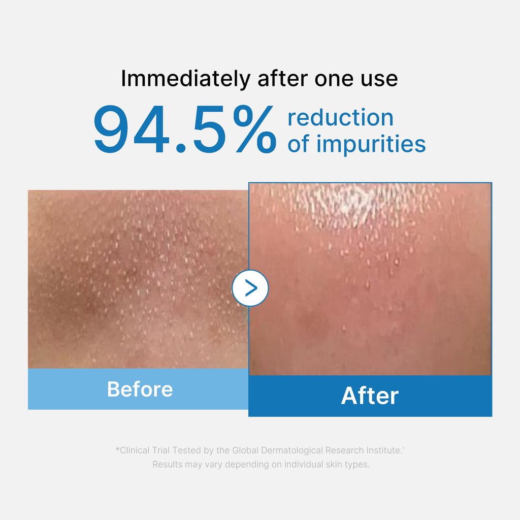 [GIFT] Zero Pore Blackhead Deep Cleansing Oil - Dewy Toner Pads