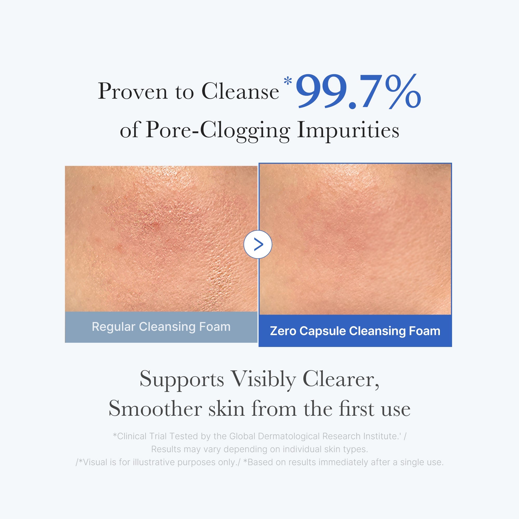 [GIFT] Zero Pore Capsule Cleansing Foam - Simple Facial Serum