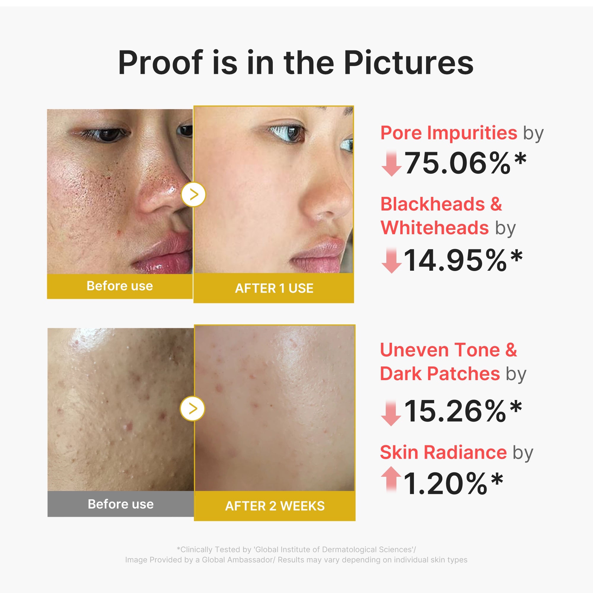 Kojic Acid Turmeric Peel Shot - Dewy Glow Drops