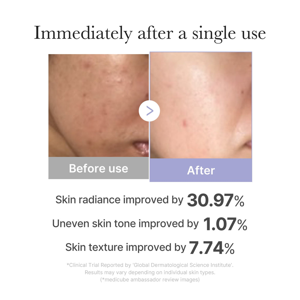 [CS] Mini Booster Pro - Simple Moisture Cream