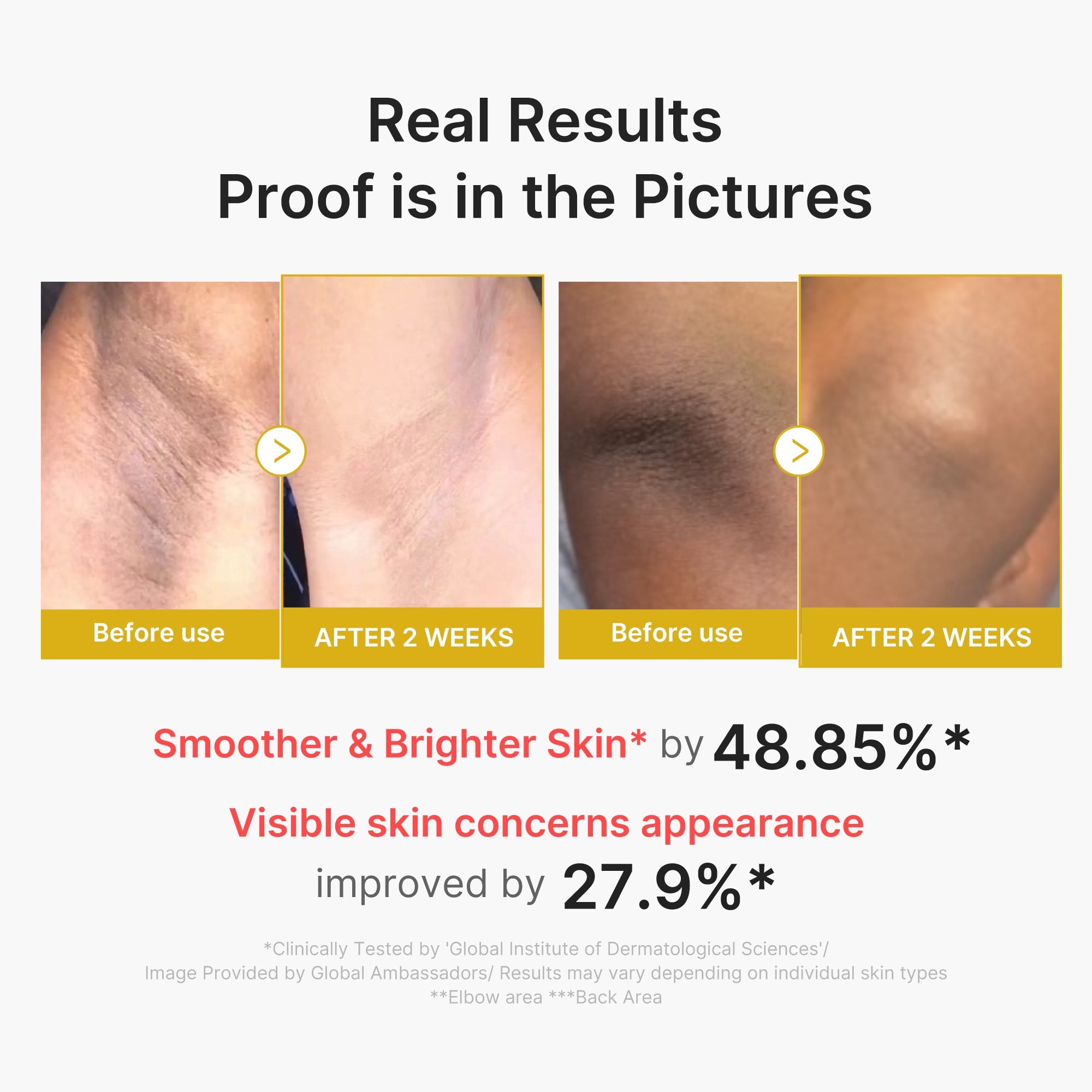 Kojic Acid Turmeric Body Peel Shot - Modern Sheet Mask