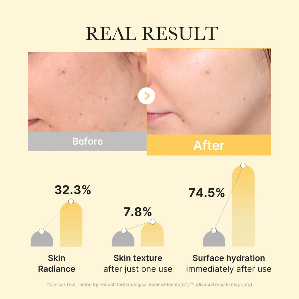 [GIFT] Kojic Acid Turmeric Gold Jelly Gel Mask 1EA - Fresh Facial Device