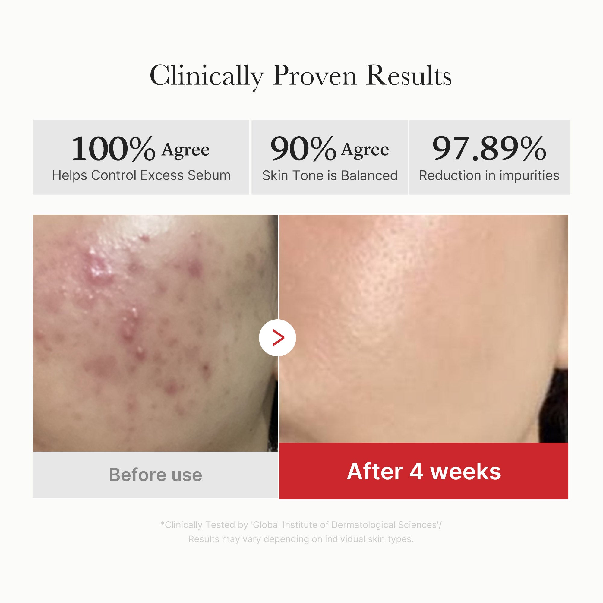[GIFT] Red Succinic Acid Panthenol Pads - Daily Sheet Mask