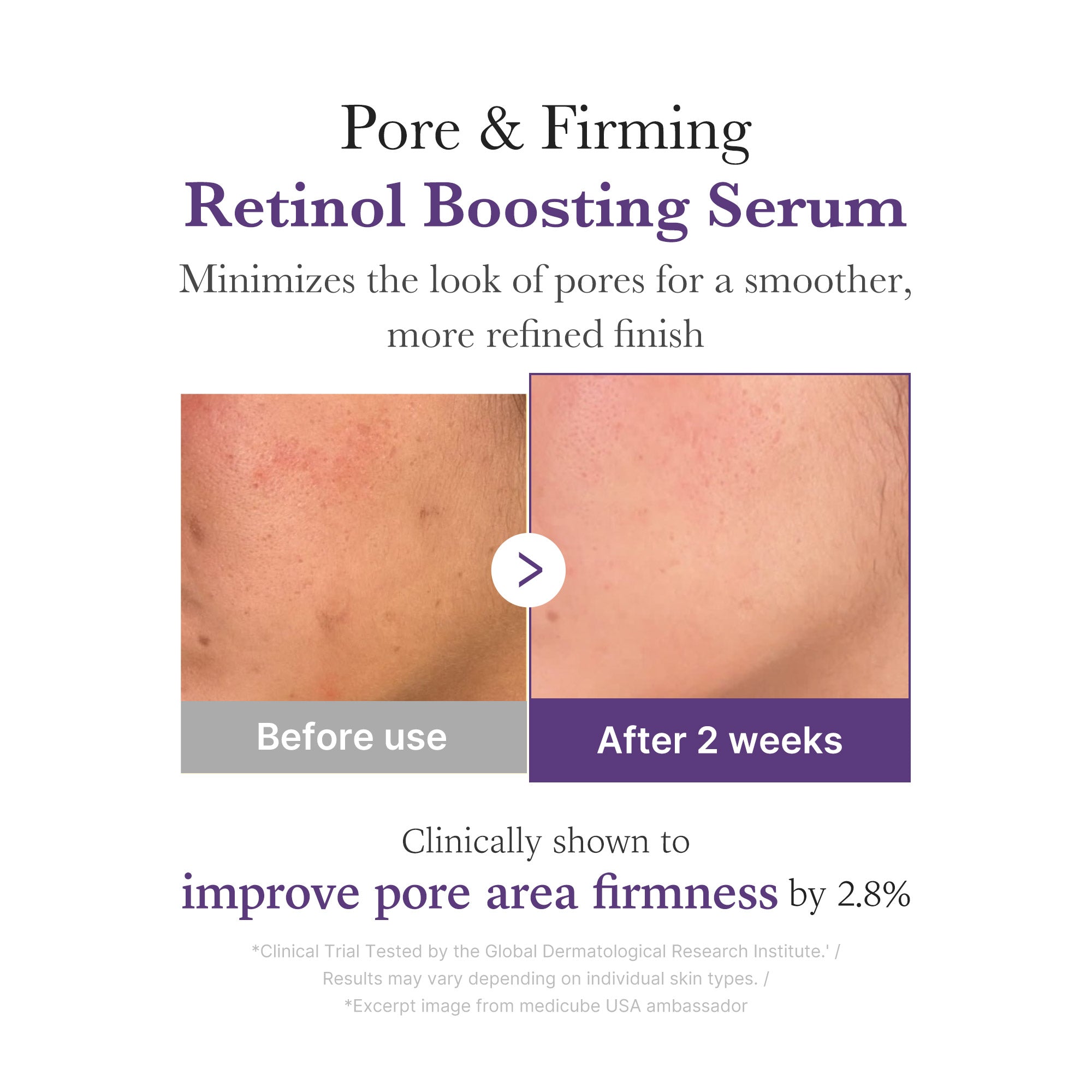 [Subscr.] Retinol NMN Boosting Serum - Self Care Facial Device
