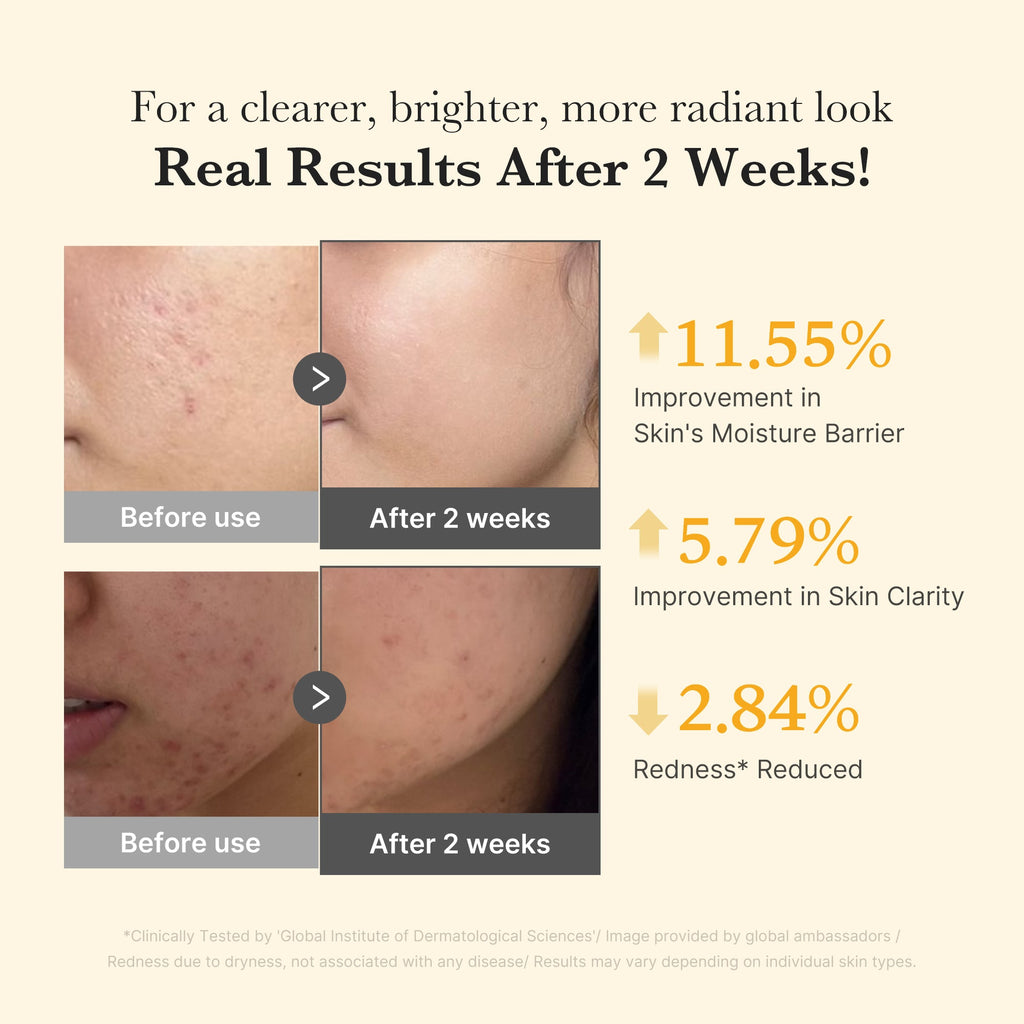 [GIFT] Kojic Acid Turmeric Capsule Serum - Daily Gel Cream