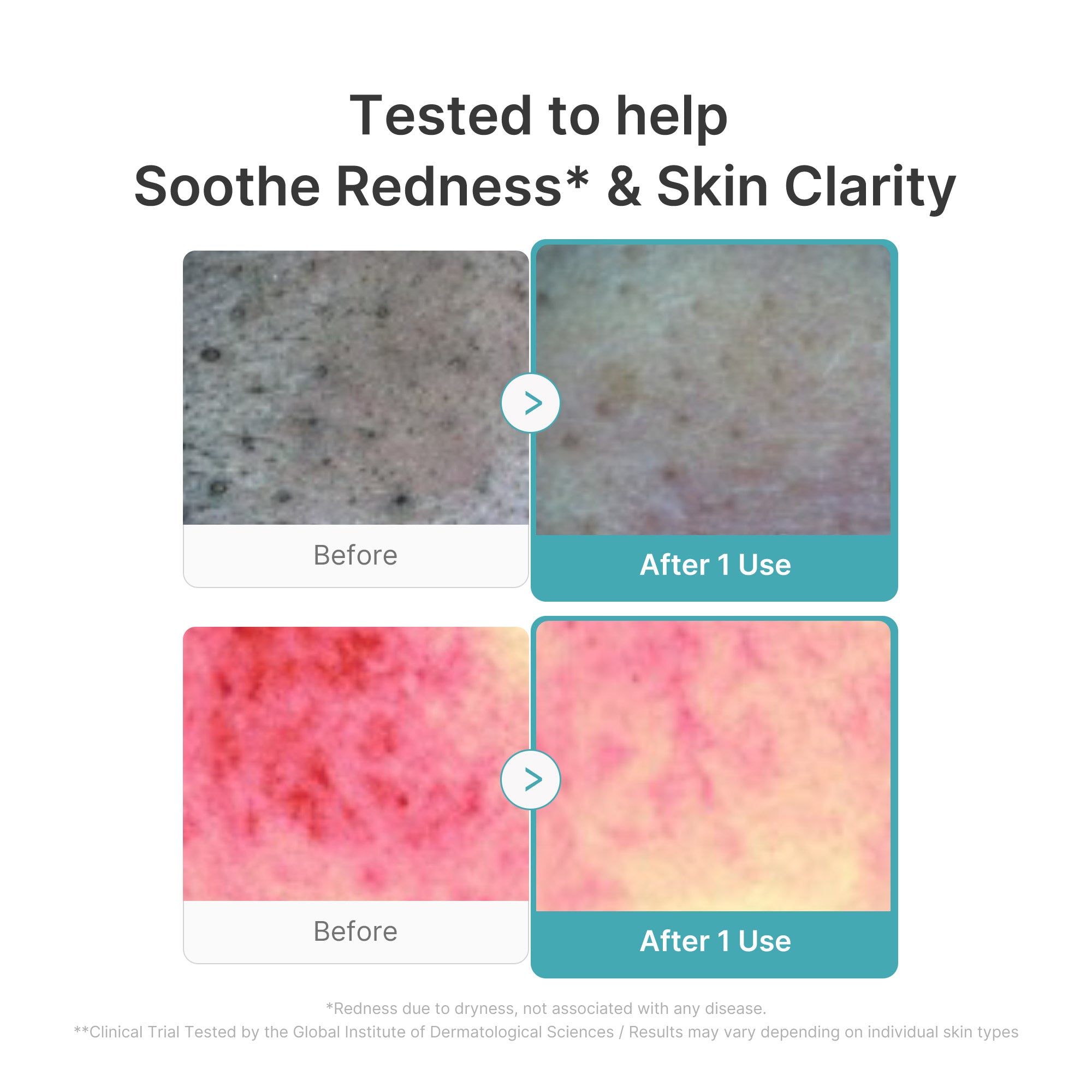 Azelaic Acid Capsule Foam Cleanser - Balanced Pore Care