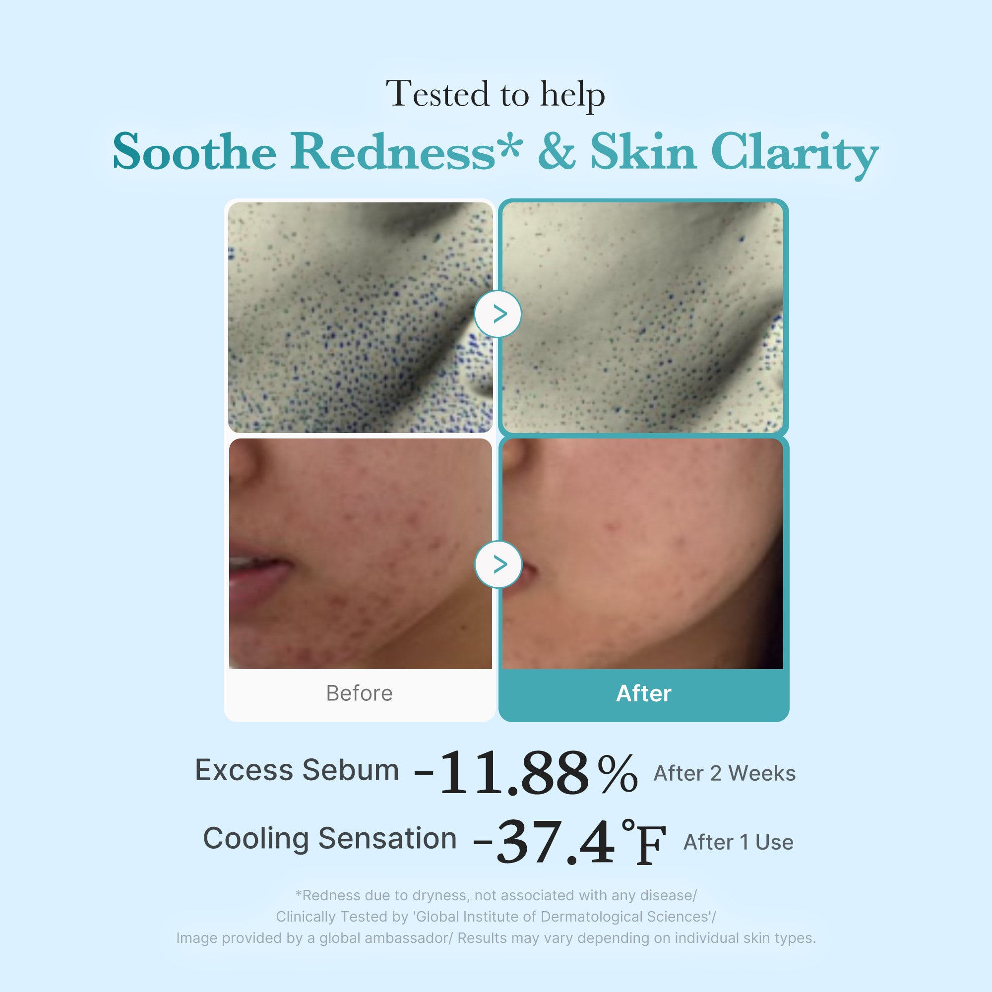 Azelaic Acid Niacinamide Clarifying Toner - Simple Exfoliating Pads