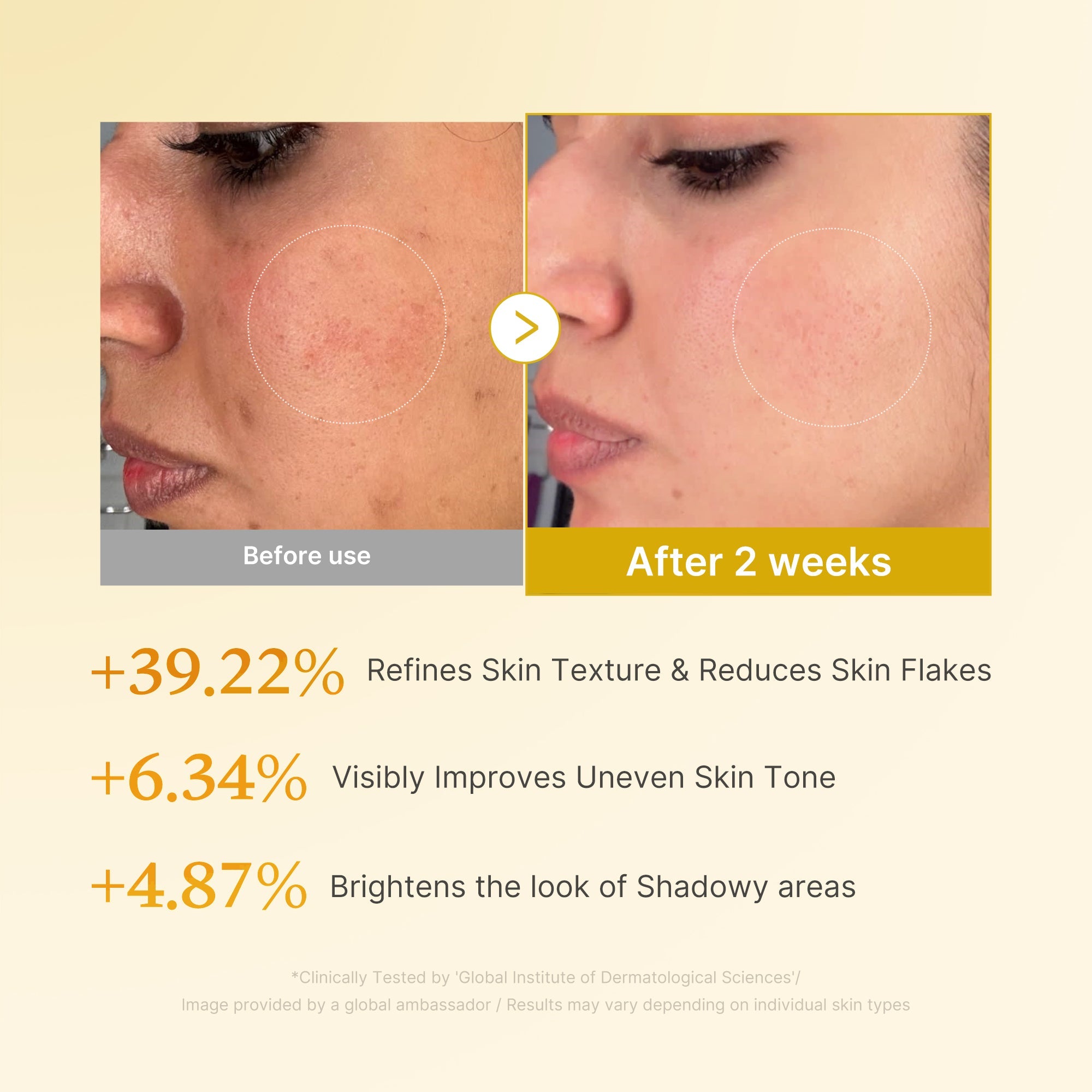 [Subscr.] Kojic Acid Turmeric Toner - Gentle Day Lotion