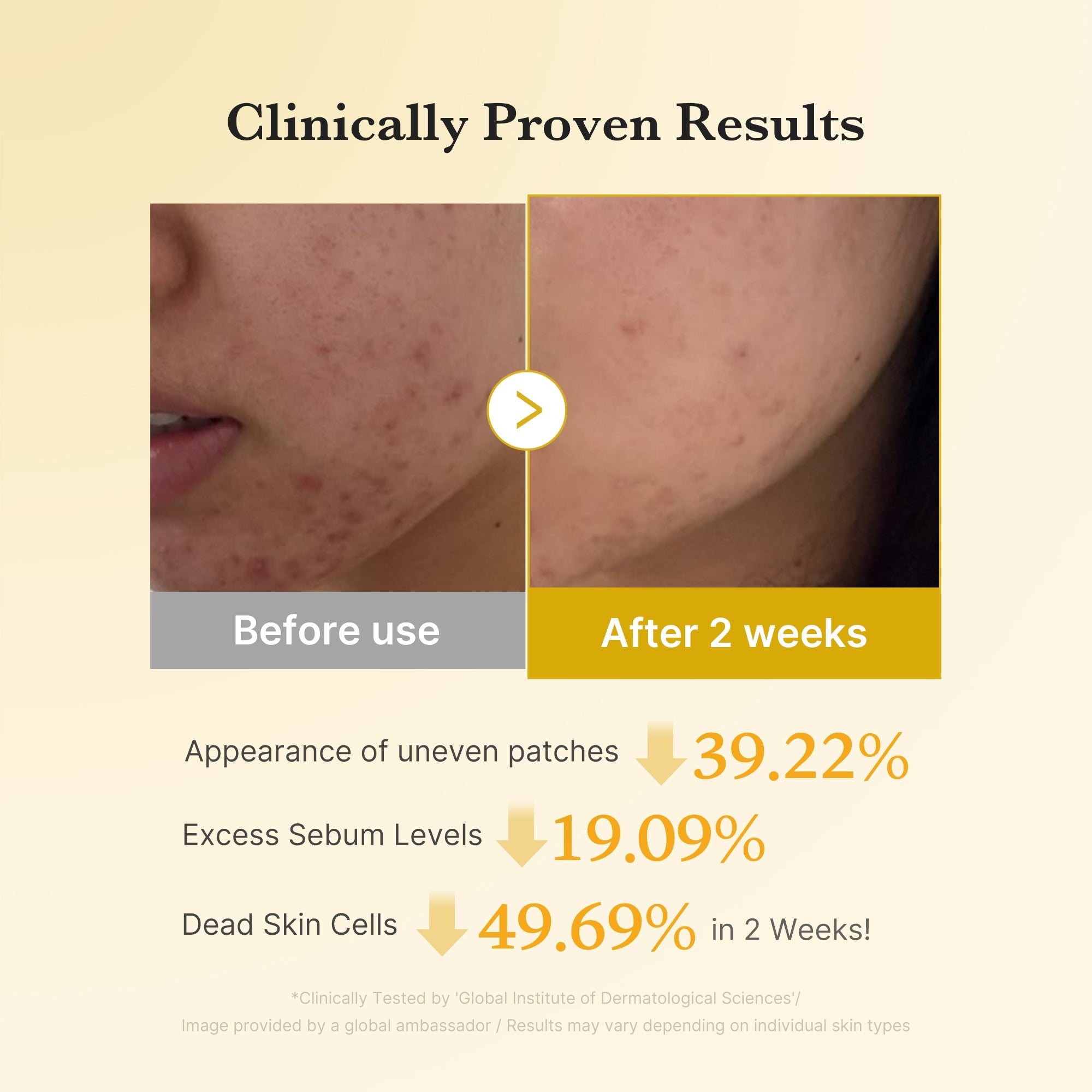 [GIFT] Kojic Acid Tumeric Toner Pad - Soft Touch Cream Cleanser