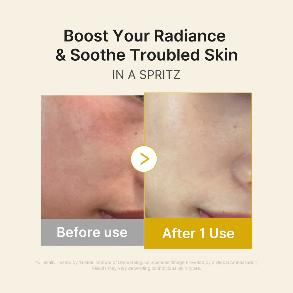 Kojic Acid Turmeric Vitamin Gold Jelly Mist Serum - Daily Balancing Toner