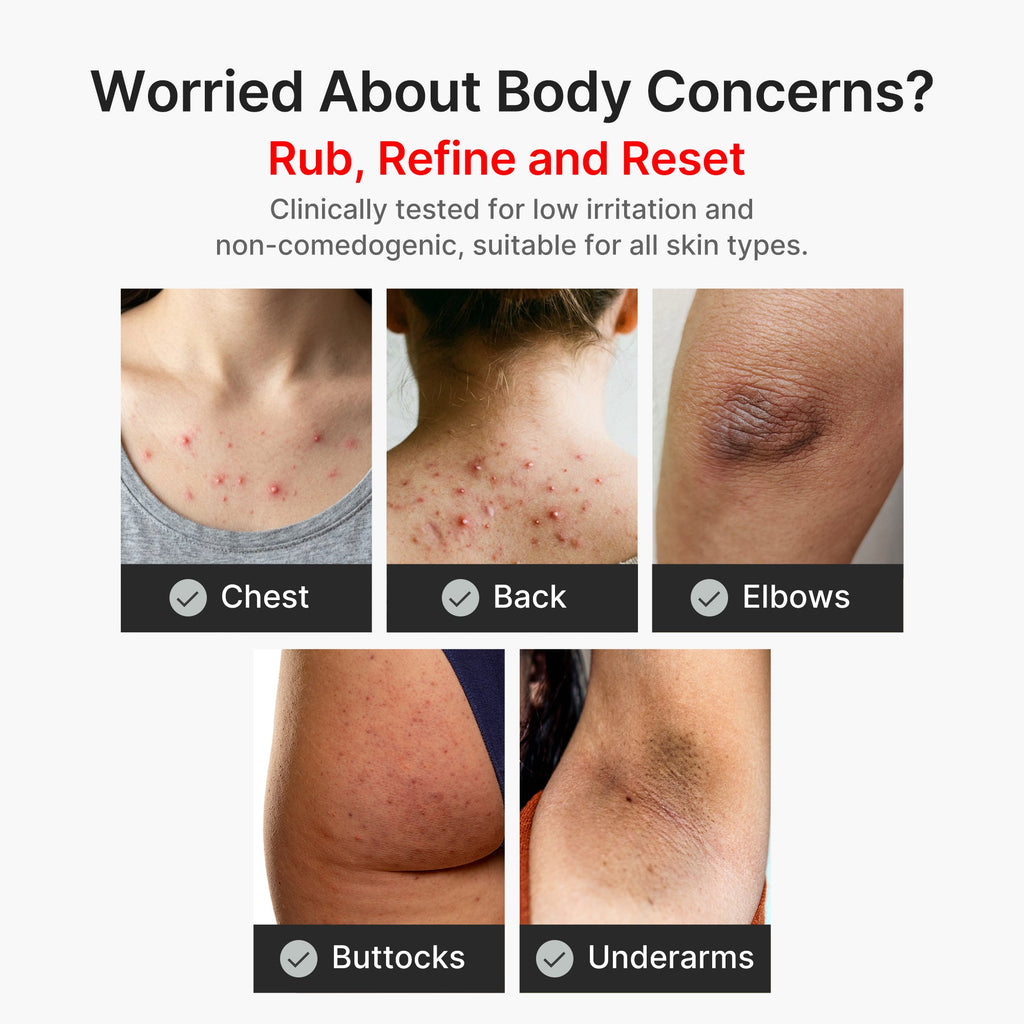 Kojic Acid Turmeric Body Peel Shot - Modern Sheet Mask