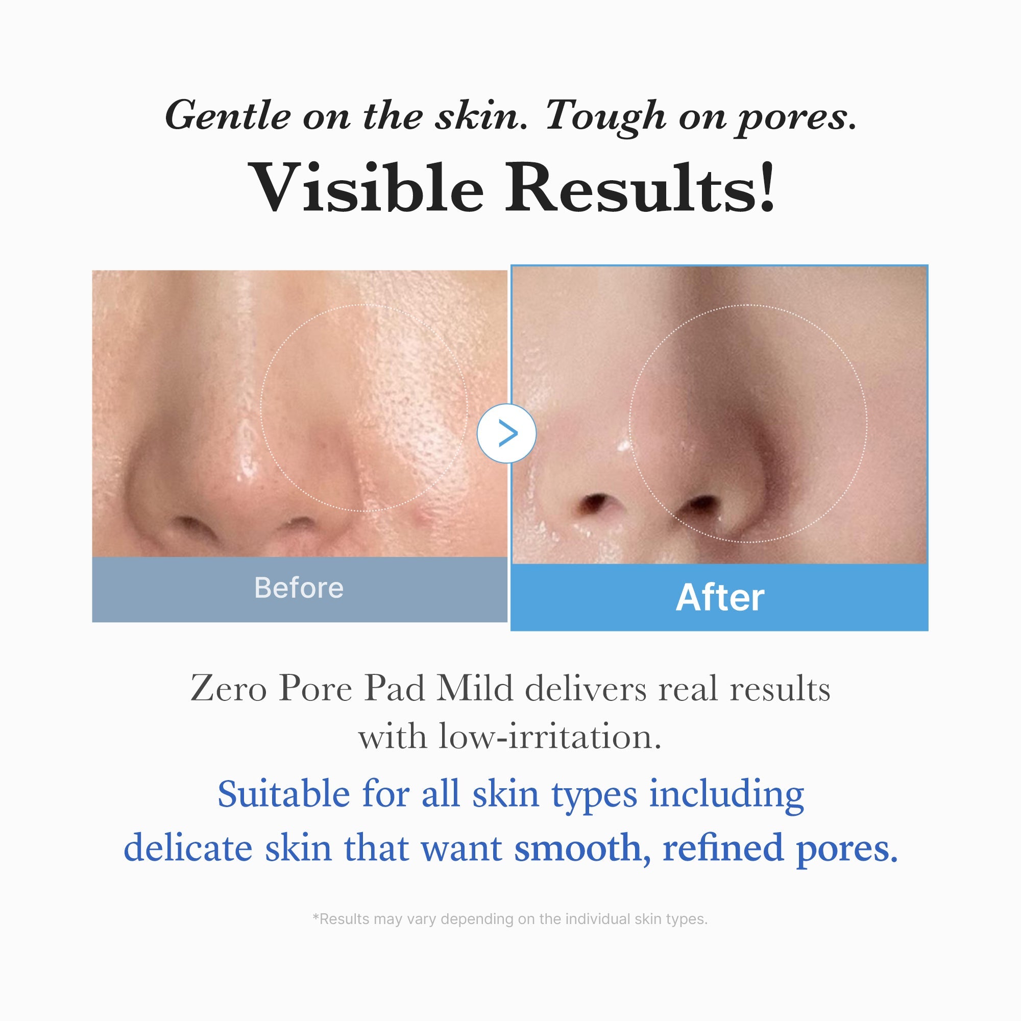 [Subscr.] Zero Pore Madecassoside Pads (Mild) - Glow Ready Hydrating Toner