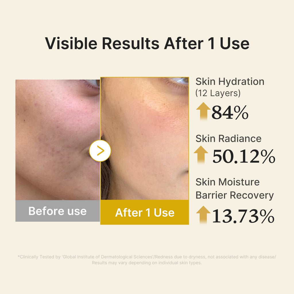 Kojic Acid Turmeric Vitamin Gold Jelly Mist Serum - Daily Balancing Toner