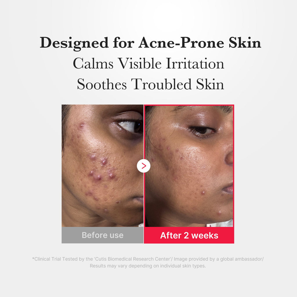 Hypochlorous Acid Power Soothing Spray - Fresh Face Sheet Mask