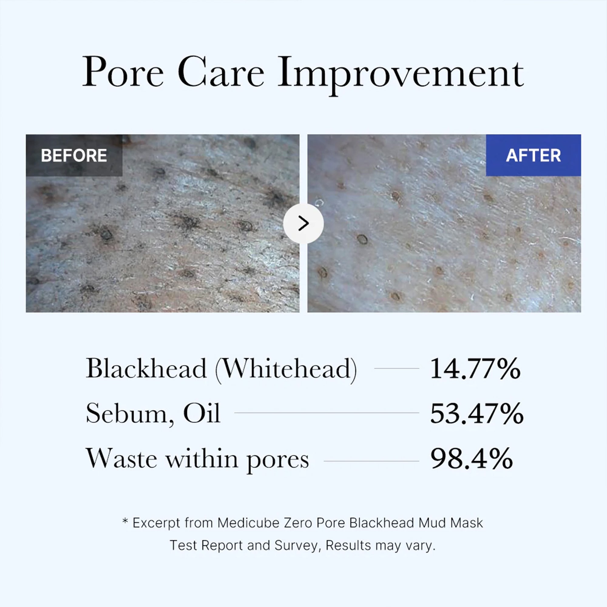 Zero Pore Blackhead Mud Mask - Radiant Facial Serum