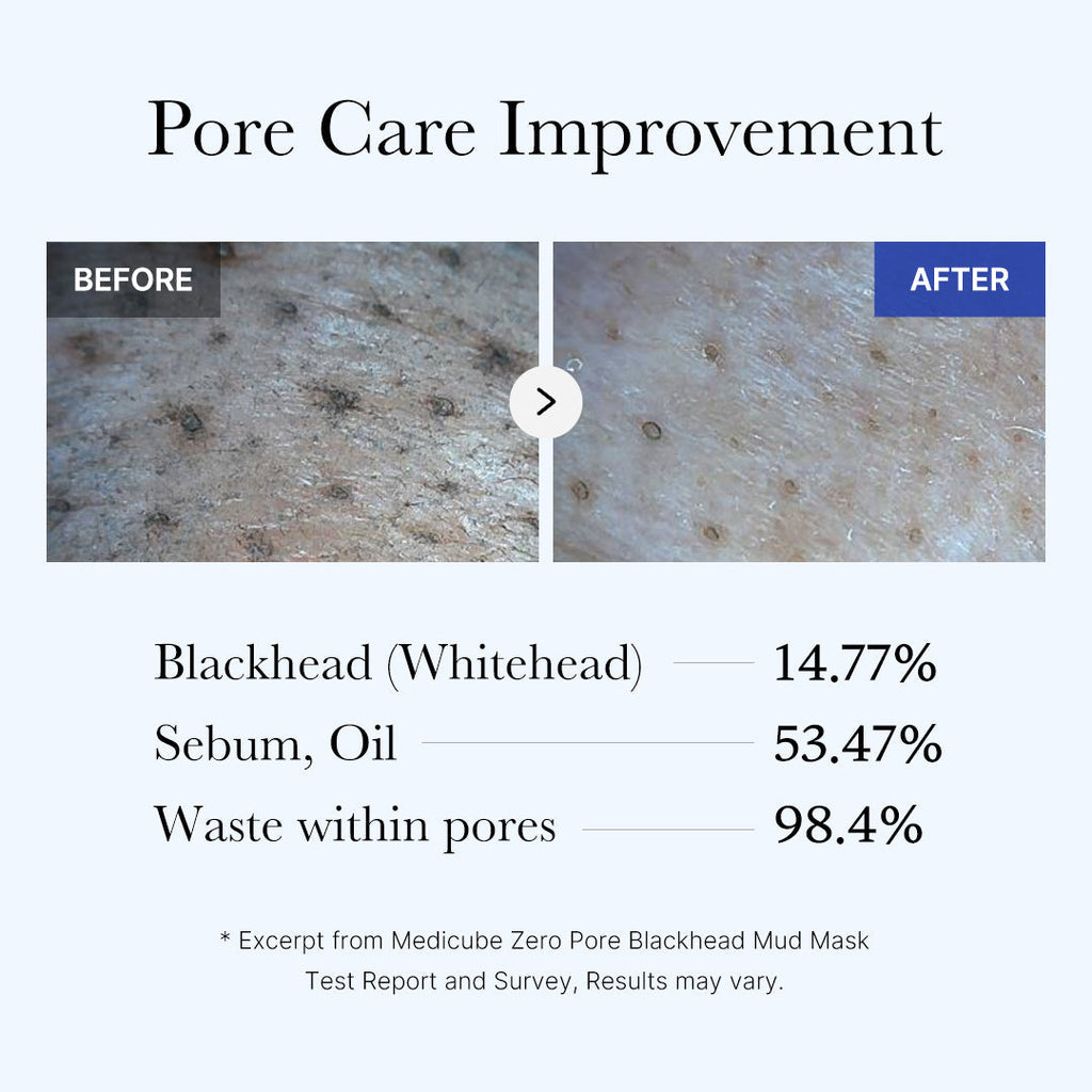 [Subscr.] Zero Pore Blackhead Mud Mask - Fresh Face Balancing Toner