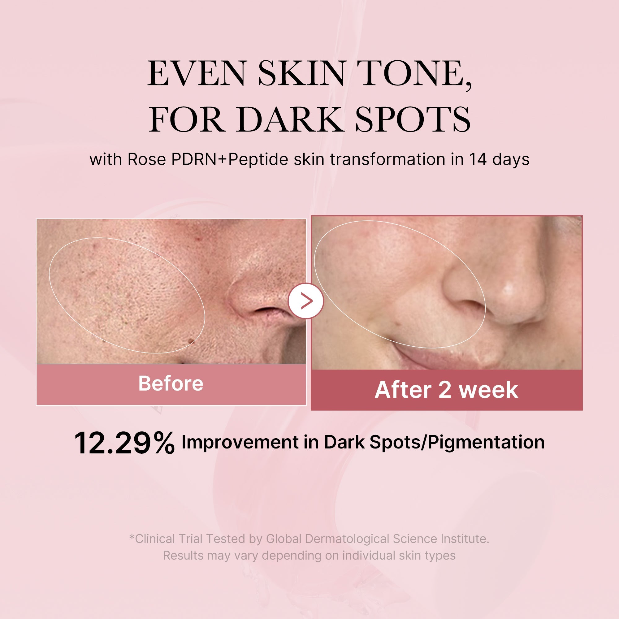 [Subscr.] PDRN Pink Peptide Toner - Soft Touch Hydrating Toner
