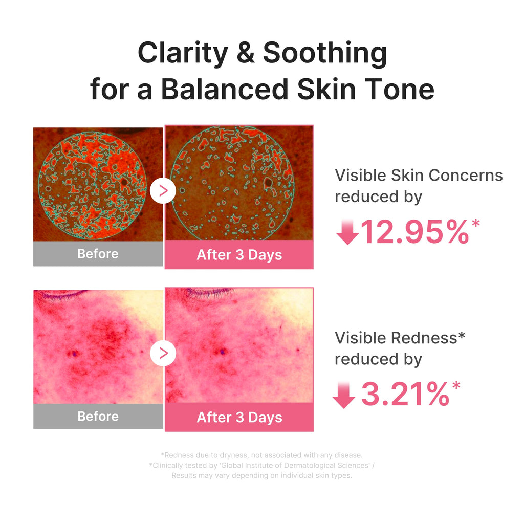 Ultra Light PDRN Pink Peptide Serum - Calm Look Balancing Toner