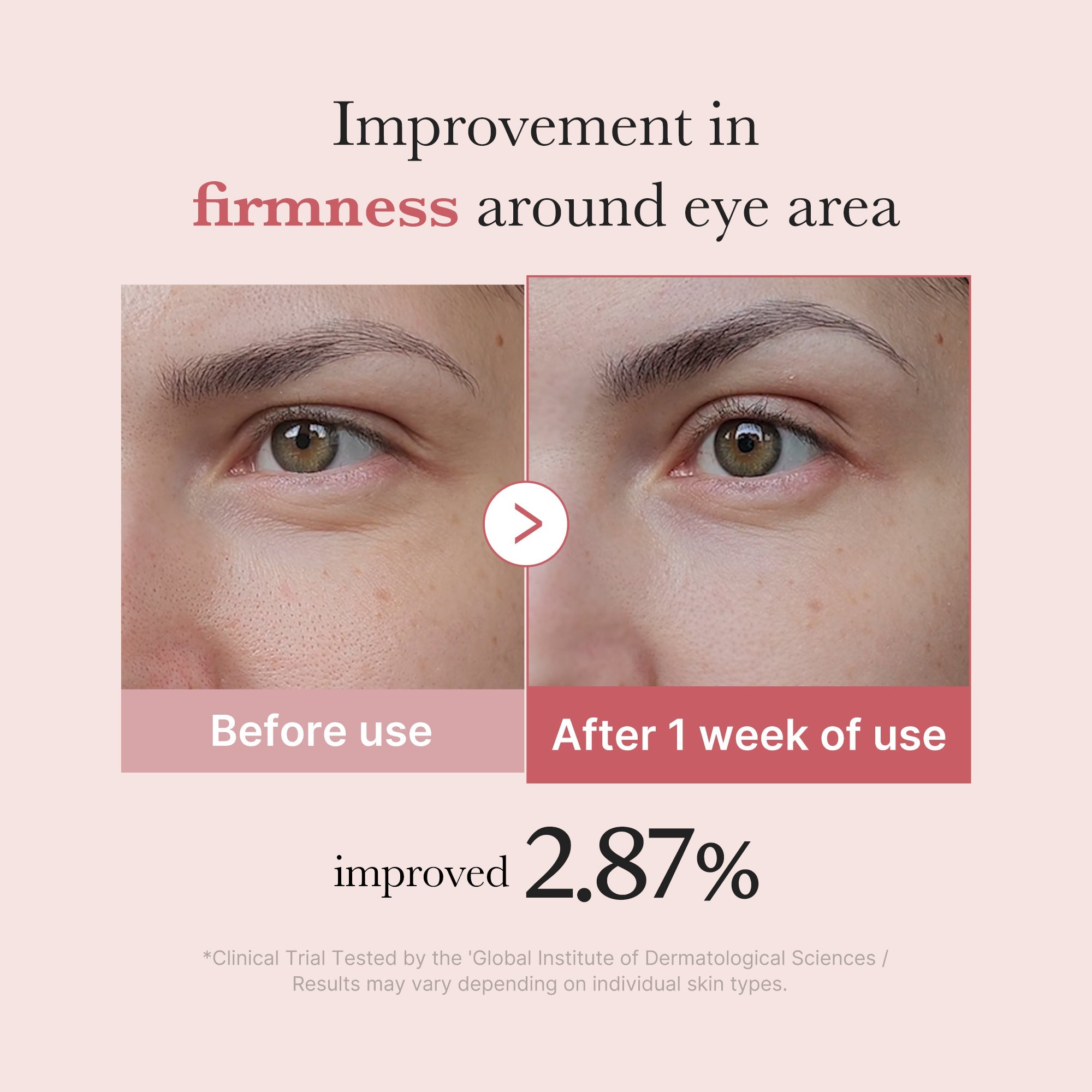 [Subscr.] PDRN Pink Peptide Eye Cream - Simple Pore Care