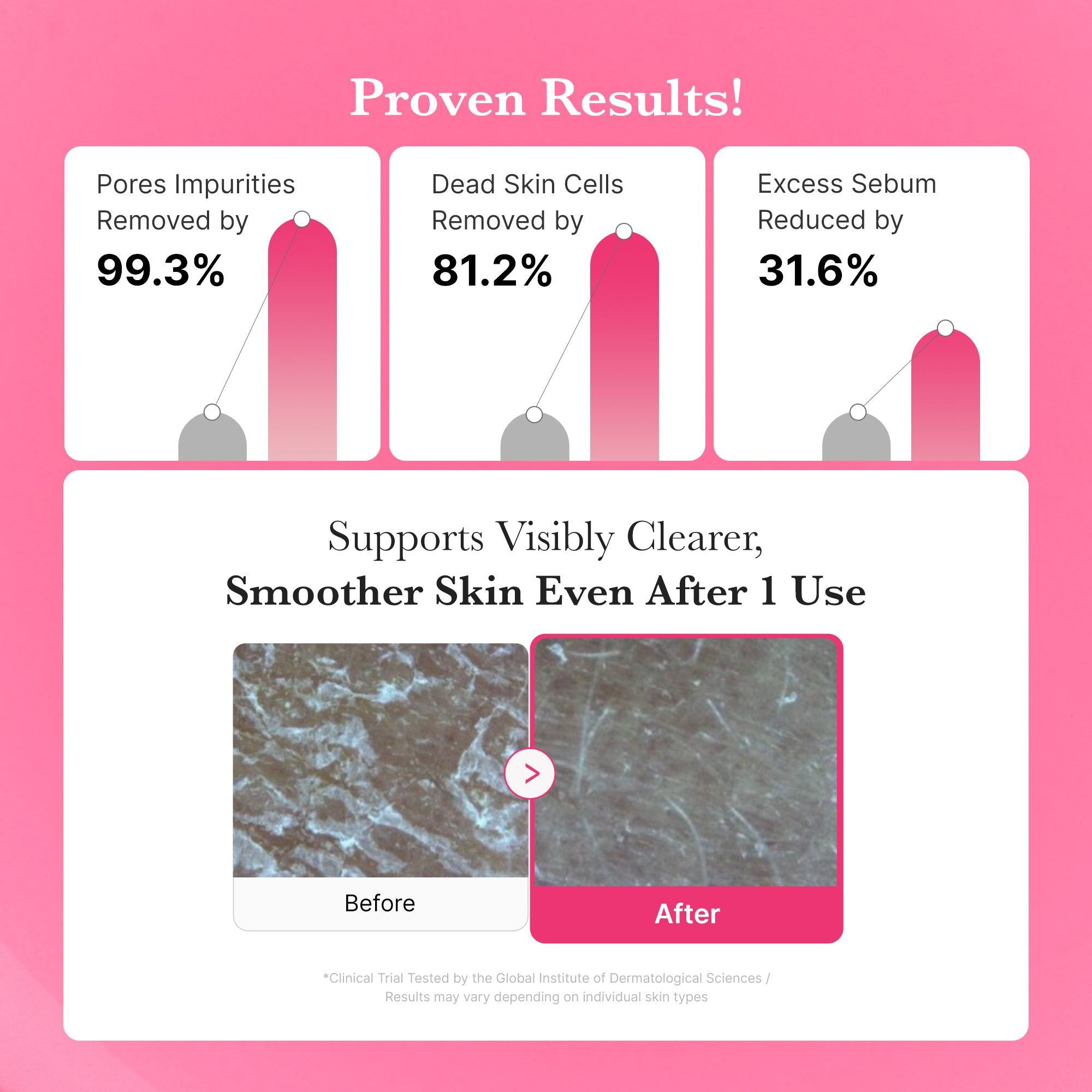 [Subscr.] PDRN Pink Gel Cleanser - Daily Pore Care