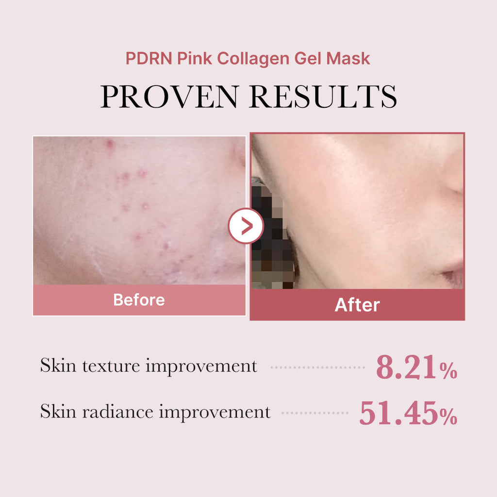 PDRN Pink Glow Full Set - Self Care Facial Serum