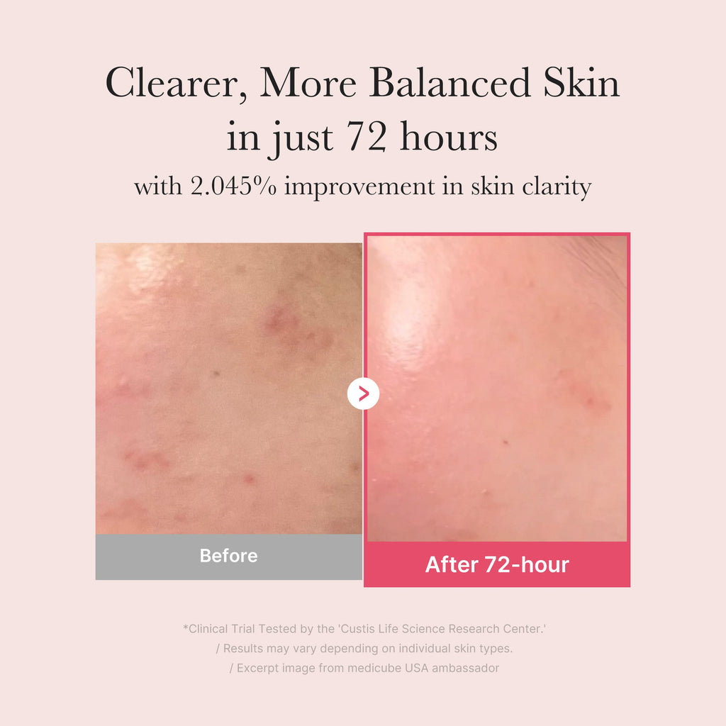 [Subscr.] TXA Niacinamide Serum - Travel Ready Facial Device
