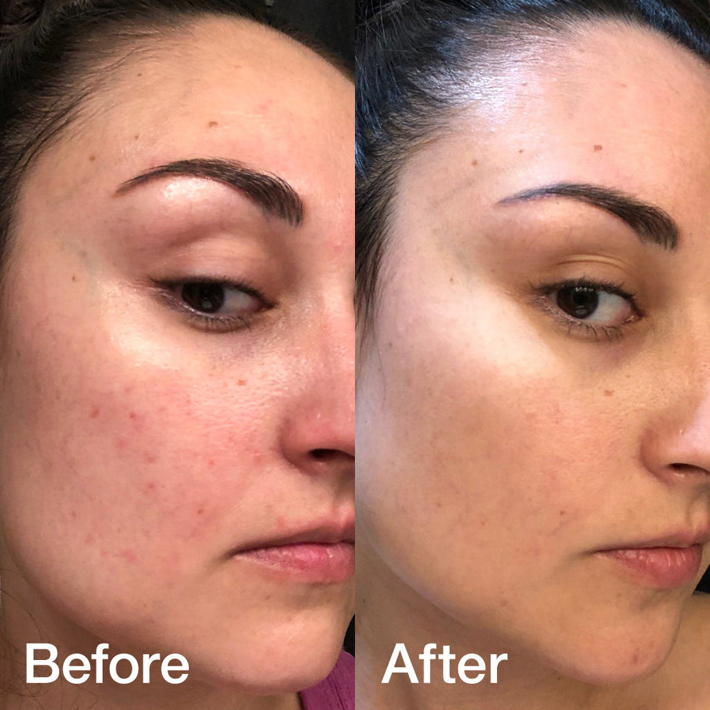 Glass Glow Duo - Lightweight Hydrating Toner